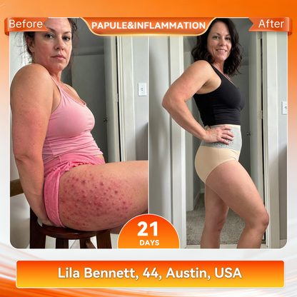 𝐎𝐟𝐟𝐢𝐜𝐢𝐚𝐥 𝐁𝐫𝐚𝐧𝐝 𝐒𝐭𝐨𝐫𝐞 | 𝐏𝐀𝐔𝐑𝐀𝐉𝐔® 🔥 𝟐𝟎𝟐𝟔 𝐌𝐨𝐫𝐢𝐧𝐠𝐚 & 𝐁𝐞𝐫𝐛𝐞𝐫𝐢𝐧𝐞 𝟒-𝐈𝐧-𝟏 𝐌𝐢𝐜𝐫𝐨-𝐏𝐚𝐫𝐭𝐢𝐜𝐥𝐞 𝐒𝐜𝐮𝐥𝐩𝐭𝐢𝐧𝐠 & 𝐅𝐚𝐭-𝐁𝐮𝐫𝐧 𝐒𝐡𝐨𝐫𝐭𝐬