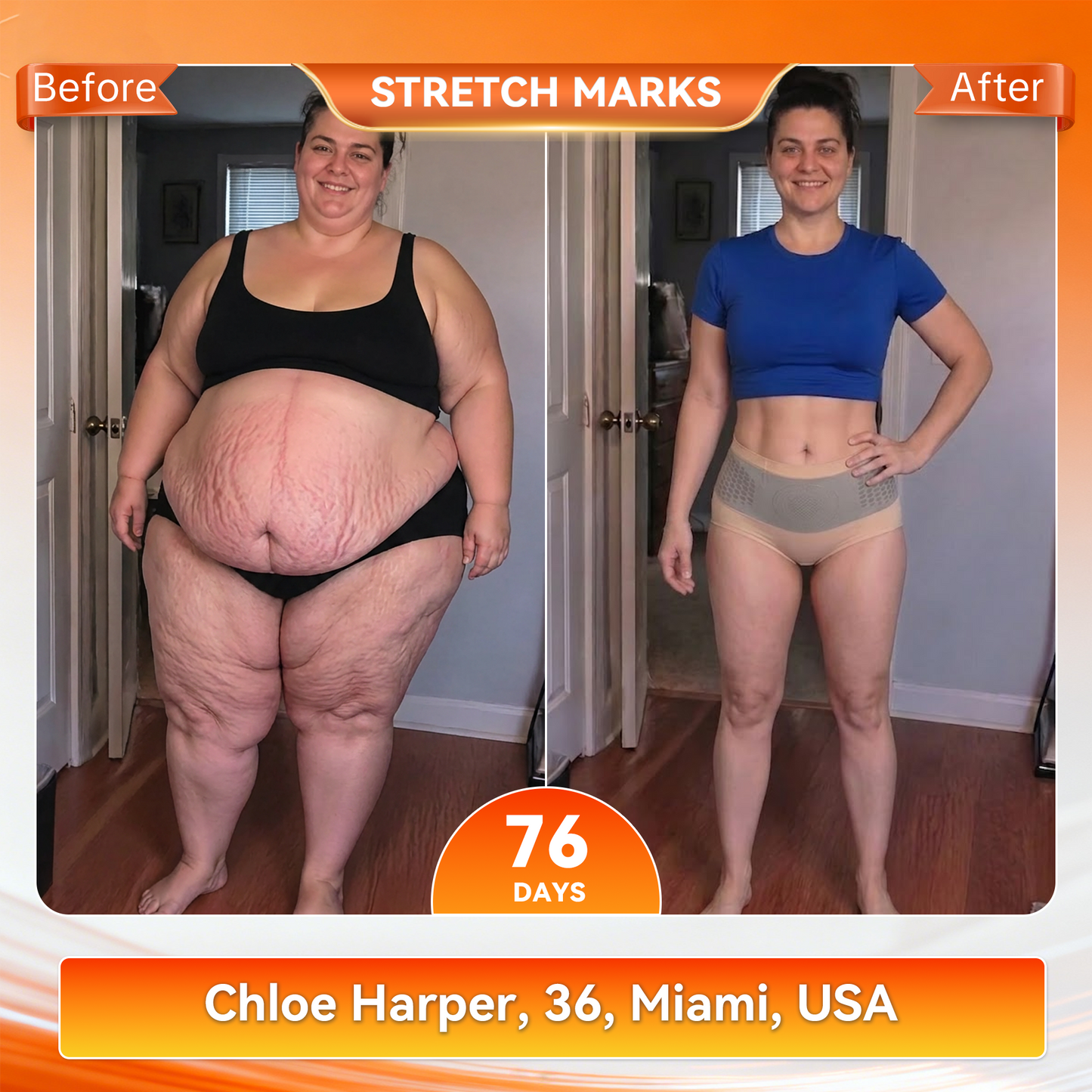 𝐎𝐟𝐟𝐢𝐜𝐢𝐚𝐥 𝐁𝐫𝐚𝐧𝐝 𝐒𝐭𝐨𝐫𝐞 | 𝐏𝐀𝐔𝐑𝐀𝐉𝐔® 🔥 𝟐𝟎𝟐𝟔 𝐌𝐨𝐫𝐢𝐧𝐠𝐚 & 𝐁𝐞𝐫𝐛𝐞𝐫𝐢𝐧𝐞 𝟒-𝐈𝐧-𝟏 𝐌𝐢𝐜𝐫𝐨-𝐏𝐚𝐫𝐭𝐢𝐜𝐥𝐞 𝐒𝐜𝐮𝐥𝐩𝐭𝐢𝐧𝐠 & 𝐅𝐚𝐭-𝐁𝐮𝐫𝐧 𝐒𝐡𝐨𝐫𝐭𝐬