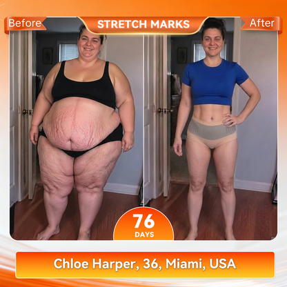 𝐎𝐟𝐟𝐢𝐜𝐢𝐚𝐥 𝐁𝐫𝐚𝐧𝐝 𝐒𝐭𝐨𝐫𝐞 | 𝐏𝐀𝐔𝐑𝐀𝐉𝐔® 🔥 𝟐𝟎𝟐𝟔 𝐌𝐨𝐫𝐢𝐧𝐠𝐚 & 𝐁𝐞𝐫𝐛𝐞𝐫𝐢𝐧𝐞 𝟒-𝐈𝐧-𝟏 𝐌𝐢𝐜𝐫𝐨-𝐏𝐚𝐫𝐭𝐢𝐜𝐥𝐞 𝐒𝐜𝐮𝐥𝐩𝐭𝐢𝐧𝐠 & 𝐅𝐚𝐭-𝐁𝐮𝐫𝐧 𝐒𝐡𝐨𝐫𝐭𝐬