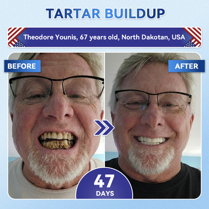 Glimmerly® 🦷 Tideglusib Fast‑Dissolving Tooth & Gum Repair Oral Strips 💭 (Supports tooth repair and helps relieve gum discomfort and other common oral concerns) 🛡️