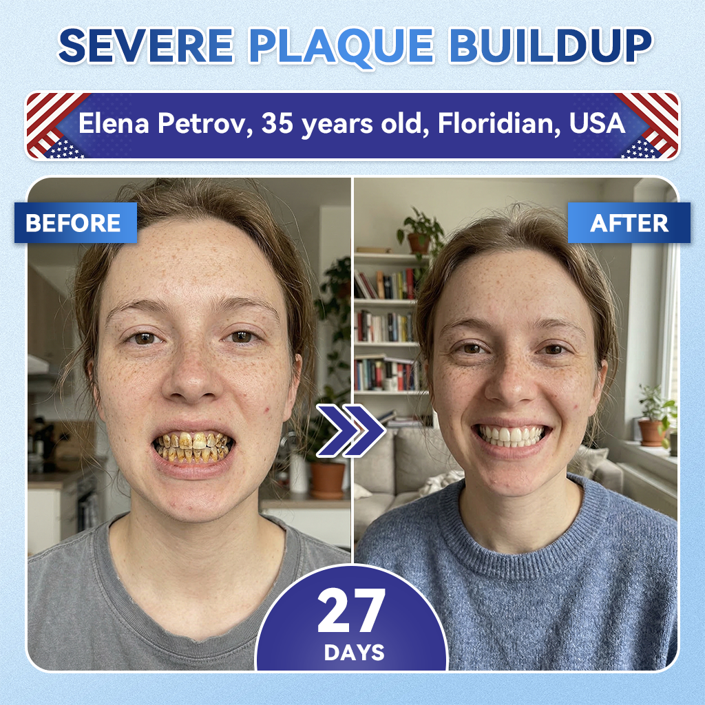 Glimmerly® 🦷 Tideglusib Fast‑Dissolving Tooth & Gum Repair Oral Strips 💭 (Supports tooth repair and helps relieve gum discomfort and other common oral concerns) 🛡️