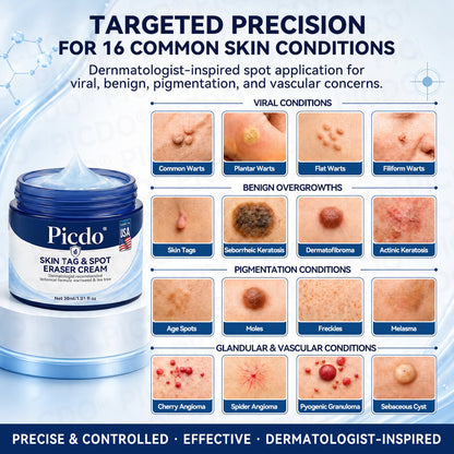 𝐏𝐢𝐜𝐝𝐨® 7-𝐃𝐚𝐲 𝐒𝐤𝐢𝐧 𝐓𝐚𝐠 & 𝐒𝐩𝐨𝐭 𝐄𝐫𝐚𝐬𝐞𝐫 𝐂𝐫𝐞𝐚𝐦 (Zero Pain, Zero 𝐒𝐜𝐚𝐫𝐬 Formula) 🪁