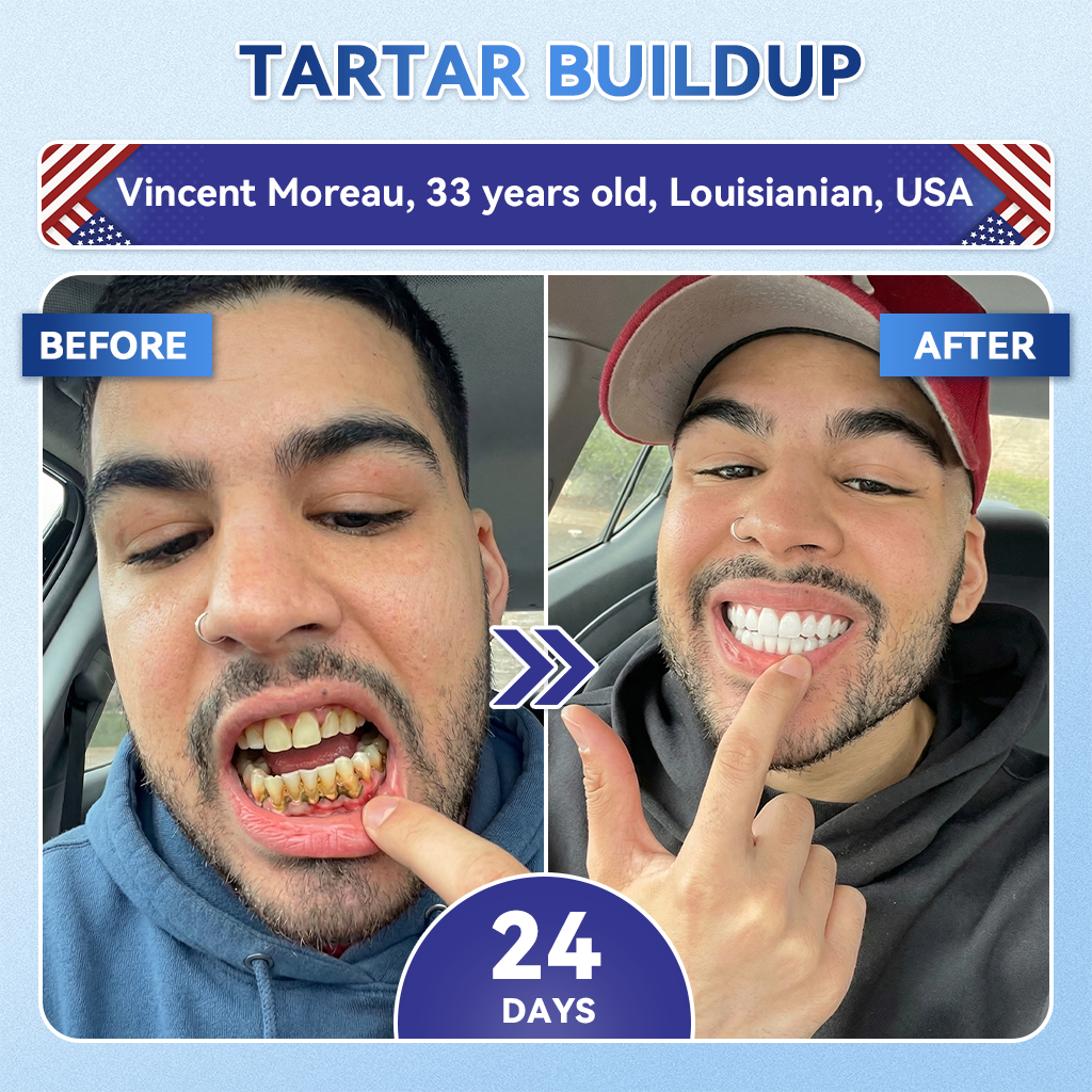 Glimmerly® 🦷 Tideglusib Fast‑Dissolving Tooth & Gum Repair Oral Strips 💭 (Supports tooth repair and helps relieve gum discomfort and other common oral concerns) 🛡️
