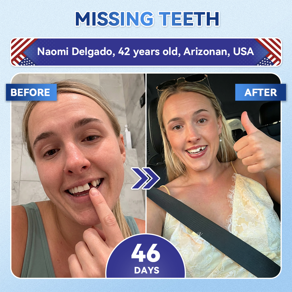 Glimmerly® 🦷 Tideglusib Fast‑Dissolving Tooth & Gum Repair Oral Strips 💭 (Supports tooth repair and helps relieve gum discomfort and other common oral concerns) 🛡️