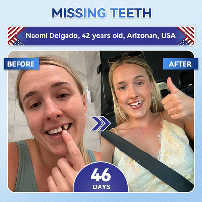 Glimmerly® 🦷 Tideglusib Fast‑Dissolving Tooth & Gum Repair Oral Strips 💭 (Supports tooth repair and helps relieve gum discomfort and other common oral concerns) 🛡️