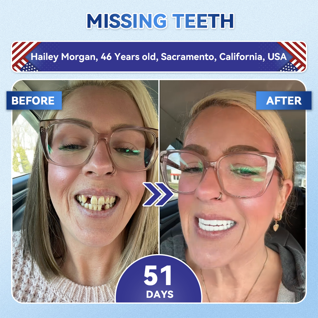 🦷𝐆𝐥𝐢𝐦𝐦𝐞𝐫𝐥𝐲® 𝐓𝐢𝐝𝐞𝐠𝐥𝐮𝐬𝐢𝐛 𝐓𝐨𝐨𝐭𝐡 & 𝐆𝐮𝐦 𝐑𝐞𝐩𝐚𝐢𝐫 𝐌𝐢𝐜𝐫𝐨𝐧𝐞𝐞𝐝𝐥𝐞 𝐏𝐚𝐭𝐜𝐡  | 𝐀𝐝𝐯𝐚𝐧𝐜𝐞𝐝 𝐒𝐭𝐞𝐦-𝐂𝐞𝐥𝐥 𝐀𝐜𝐭𝐢𝐯𝐚𝐭𝐢𝐨𝐧 𝐓𝐞𝐞𝐭𝐡 𝐒𝐭𝐫𝐢𝐩𝐬 ✨🎉 (𝐑𝐞𝐛𝐮𝐢𝐥𝐝 𝐄𝐧𝐚𝐦𝐞𝐥 & 𝐃𝐞𝐧𝐭𝐢𝐧 • 𝐒𝐭𝐫𝐞𝐧𝐠𝐭𝐡𝐞𝐧 𝐆𝐮𝐦𝐬 • 𝐄𝐫𝐚𝐝𝐢𝐜𝐚𝐭𝐞 𝐓𝐚𝐫𝐭𝐚𝐫 & 𝐎𝐝𝐨𝐫 • 𝐒𝐭𝐨𝐩 𝐓𝐨𝐨𝐭𝐡 𝐒𝐞𝐧𝐬𝐢𝐭𝐢𝐯𝐢𝐭𝐲)