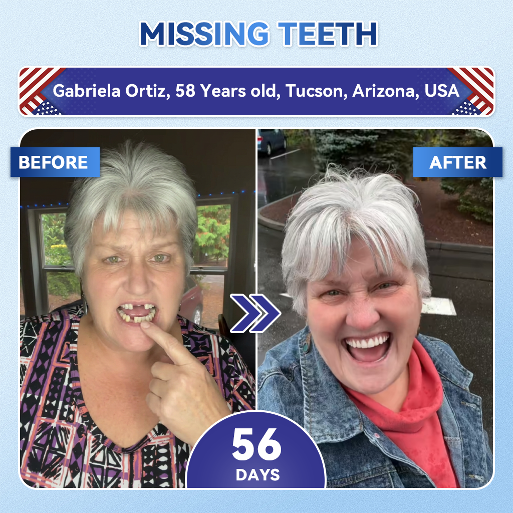 🦷𝐆𝐥𝐢𝐦𝐦𝐞𝐫𝐥𝐲® 𝐓𝐢𝐝𝐞𝐠𝐥𝐮𝐬𝐢𝐛 𝐓𝐨𝐨𝐭𝐡 & 𝐆𝐮𝐦 𝐑𝐞𝐩𝐚𝐢𝐫 𝐌𝐢𝐜𝐫𝐨𝐧𝐞𝐞𝐝𝐥𝐞 𝐏𝐚𝐭𝐜𝐡  | 𝐀𝐝𝐯𝐚𝐧𝐜𝐞𝐝 𝐒𝐭𝐞𝐦-𝐂𝐞𝐥𝐥 𝐀𝐜𝐭𝐢𝐯𝐚𝐭𝐢𝐨𝐧 𝐓𝐞𝐞𝐭𝐡 𝐒𝐭𝐫𝐢𝐩𝐬 ✨🎉 (𝐑𝐞𝐛𝐮𝐢𝐥𝐝 𝐄𝐧𝐚𝐦𝐞𝐥 & 𝐃𝐞𝐧𝐭𝐢𝐧 • 𝐒𝐭𝐫𝐞𝐧𝐠𝐭𝐡𝐞𝐧 𝐆𝐮𝐦𝐬 • 𝐄𝐫𝐚𝐝𝐢𝐜𝐚𝐭𝐞 𝐓𝐚𝐫𝐭𝐚𝐫 & 𝐎𝐝𝐨𝐫 • 𝐒𝐭𝐨𝐩 𝐓𝐨𝐨𝐭𝐡 𝐒𝐞𝐧𝐬𝐢𝐭𝐢𝐯𝐢𝐭𝐲)