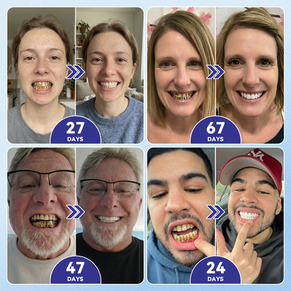 🦷𝐆𝐥𝐢𝐦𝐦𝐞𝐫𝐥𝐲® 𝐓𝐢𝐝𝐞𝐠𝐥𝐮𝐬𝐢𝐛 𝐓𝐨𝐨𝐭𝐡 & 𝐆𝐮𝐦 𝐑𝐞𝐩𝐚𝐢𝐫 𝐌𝐢𝐜𝐫𝐨𝐧𝐞𝐞𝐝𝐥𝐞 𝐏𝐚𝐭𝐜𝐡  | 𝐀𝐝𝐯𝐚𝐧𝐜𝐞𝐝 𝐒𝐭𝐞𝐦-𝐂𝐞𝐥𝐥 𝐀𝐜𝐭𝐢𝐯𝐚𝐭𝐢𝐨𝐧 𝐓𝐞𝐞𝐭𝐡 𝐒𝐭𝐫𝐢𝐩𝐬 ✨🎉 (𝐑𝐞𝐛𝐮𝐢𝐥𝐝 𝐄𝐧𝐚𝐦𝐞𝐥 & 𝐃𝐞𝐧𝐭𝐢𝐧 • 𝐒𝐭𝐫𝐞𝐧𝐠𝐭𝐡𝐞𝐧 𝐆𝐮𝐦𝐬 • 𝐄𝐫𝐚𝐝𝐢𝐜𝐚𝐭𝐞 𝐓𝐚𝐫𝐭𝐚𝐫 & 𝐎𝐝𝐨𝐫 • 𝐒𝐭𝐨𝐩 𝐓𝐨𝐨𝐭𝐡 𝐒𝐞𝐧𝐬𝐢𝐭𝐢𝐯𝐢𝐭𝐲)