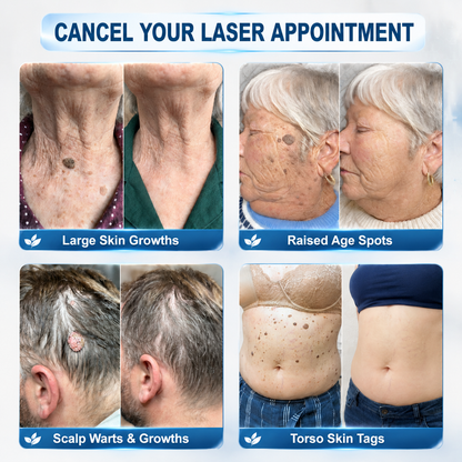 𝐎𝐟𝐟𝐢𝐜𝐢𝐚𝐥 𝐁𝐫𝐚𝐧𝐝 𝐒𝐭𝐨𝐫𝐞 💎 | 𝐏i𝐜𝐝o® 7-𝐷𝑎𝑦 𝗧𝐚𝐠 & 𝗦𝗽𝐨𝐭 𝐄𝐫𝒂𝒔𝒆𝒓(Zero Pain, Zero 𝐒𝐜𝐚𝒓𝒔 Rollerball) 💎