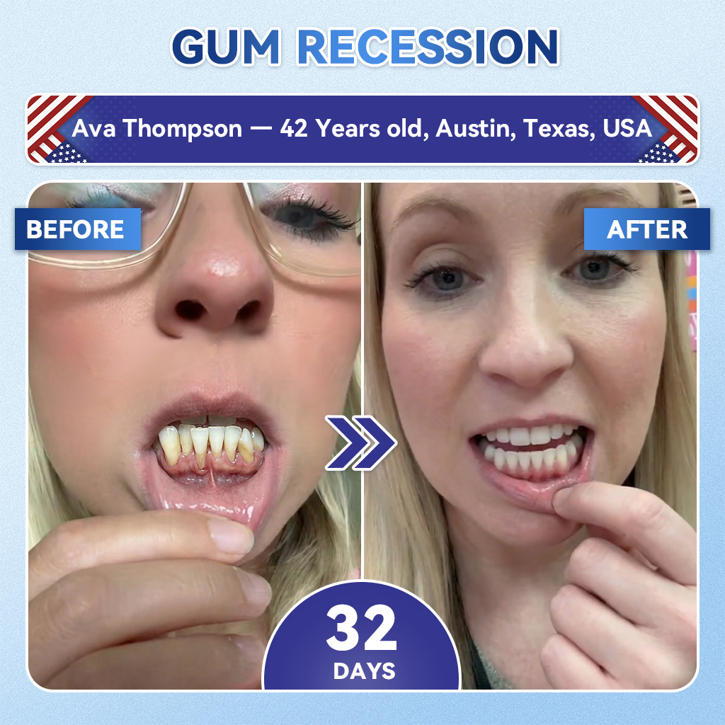 🦷𝐆𝐥𝐢𝐦𝐦𝐞𝐫𝐥𝐲® 𝐓𝐢𝐝𝐞𝐠𝐥𝐮𝐬𝐢𝐛 𝐓𝐨𝐨𝐭𝐡 & 𝐆𝐮𝐦 𝐑𝐞𝐩𝐚𝐢𝐫 𝐌𝐢𝐜𝐫𝐨𝐧𝐞𝐞𝐝𝐥𝐞 𝐏𝐚𝐭𝐜𝐡  | 𝐀𝐝𝐯𝐚𝐧𝐜𝐞𝐝 𝐒𝐭𝐞𝐦-𝐂𝐞𝐥𝐥 𝐀𝐜𝐭𝐢𝐯𝐚𝐭𝐢𝐨𝐧 𝐓𝐞𝐞𝐭𝐡 𝐒𝐭𝐫𝐢𝐩𝐬 ✨🎉 (𝐑𝐞𝐛𝐮𝐢𝐥𝐝 𝐄𝐧𝐚𝐦𝐞𝐥 & 𝐃𝐞𝐧𝐭𝐢𝐧 • 𝐒𝐭𝐫𝐞𝐧𝐠𝐭𝐡𝐞𝐧 𝐆𝐮𝐦𝐬 • 𝐄𝐫𝐚𝐝𝐢𝐜𝐚𝐭𝐞 𝐓𝐚𝐫𝐭𝐚𝐫 & 𝐎𝐝𝐨𝐫 • 𝐒𝐭𝐨𝐩 𝐓𝐨𝐨𝐭𝐡 𝐒𝐞𝐧𝐬𝐢𝐭𝐢𝐯𝐢𝐭𝐲)